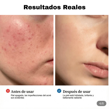 LAKERAIN® 345 Relief Cream